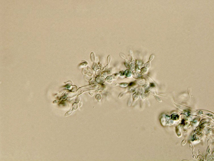 Cordyceps lepidopterorum